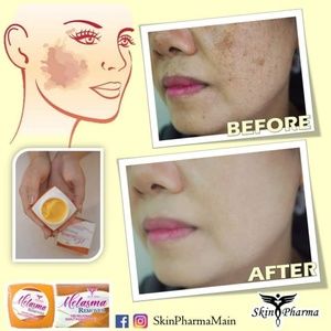 Skin Pharma Melasma Remover